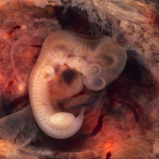 Cientistas da Coreia do Sul foram a primeira equipa a clonar com sucesso um embrião humano